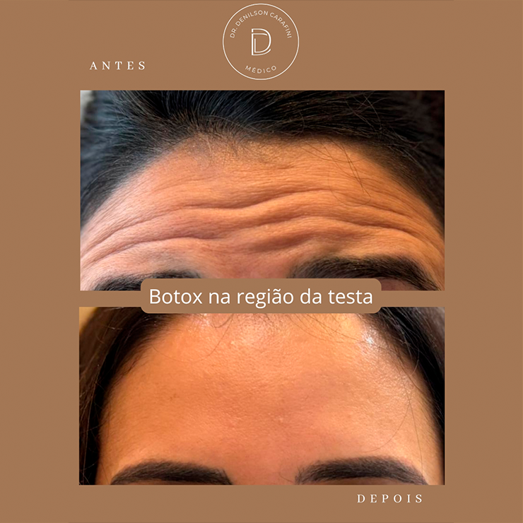 IMG CARROSSEL RESULTADOS 01