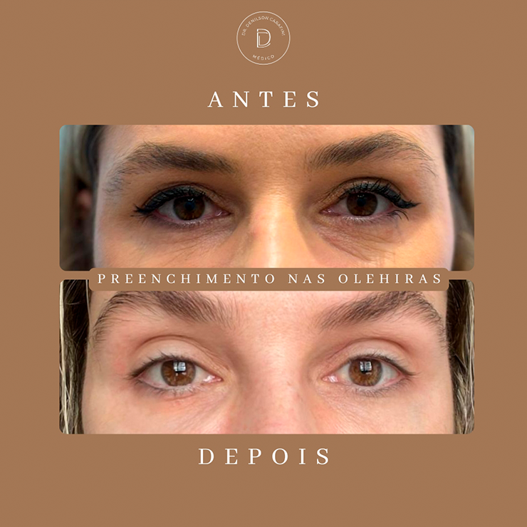 IMG CARROSSEL RESULTADOS 02