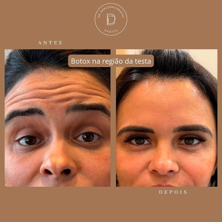 IMG CARROSSEL RESULTADOS 03