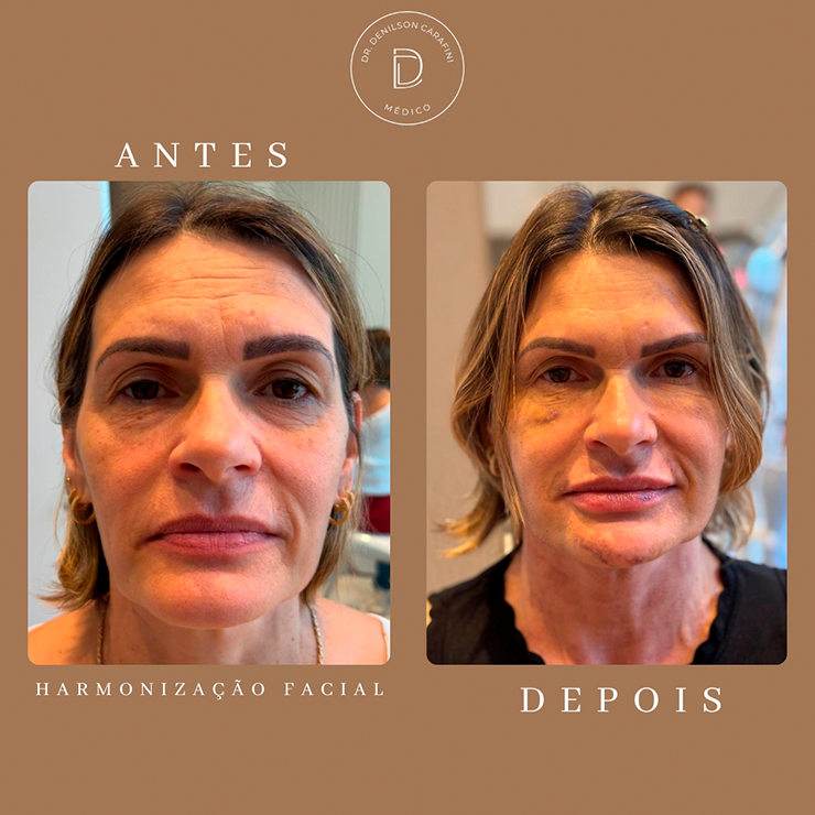 IMG CARROSSEL RESULTADOS 04