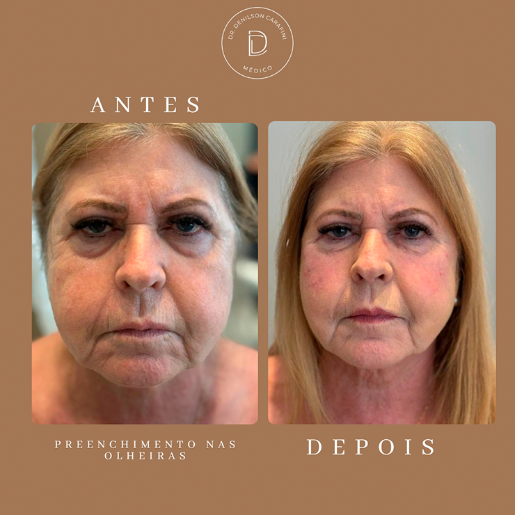 IMG CARROSSEL RESULTADOS 05